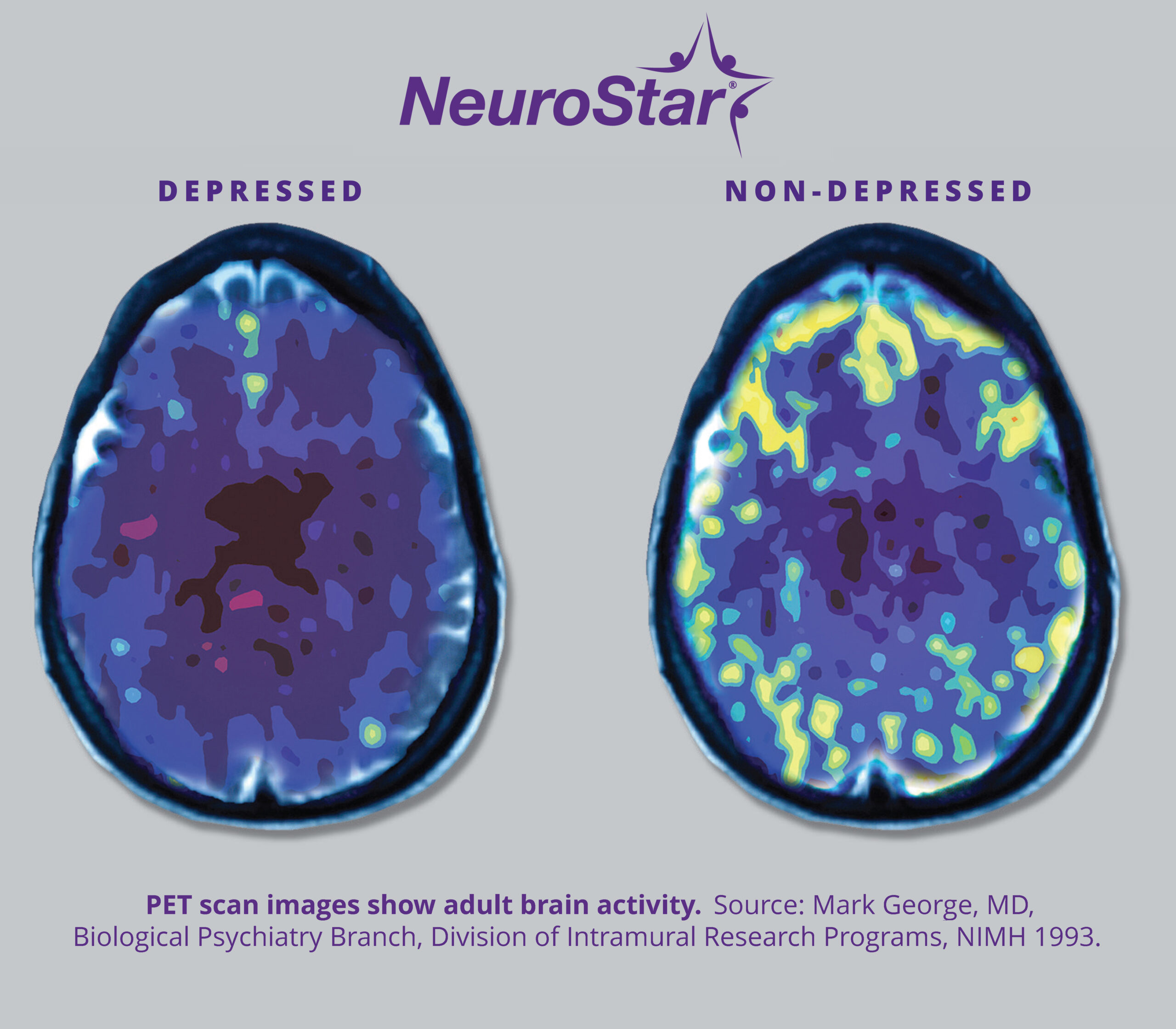 Gray Mark George Brain Scan Image