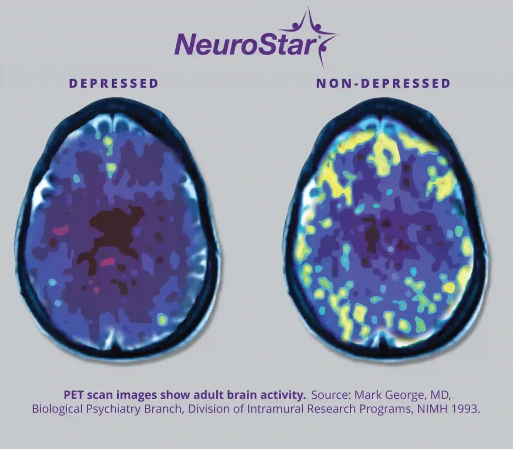 Gray Mark George Brain Scan Image